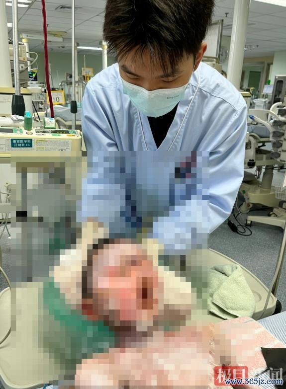 9岁男孩全身溃烂 病因竟是常用药 常见退热药激励严重响应